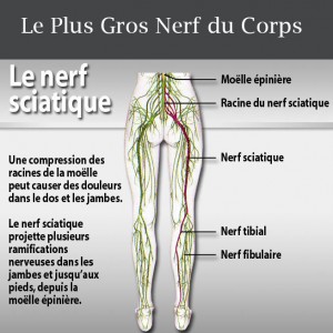 Sciatica5