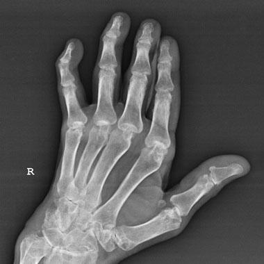X-ray-ArtW2
